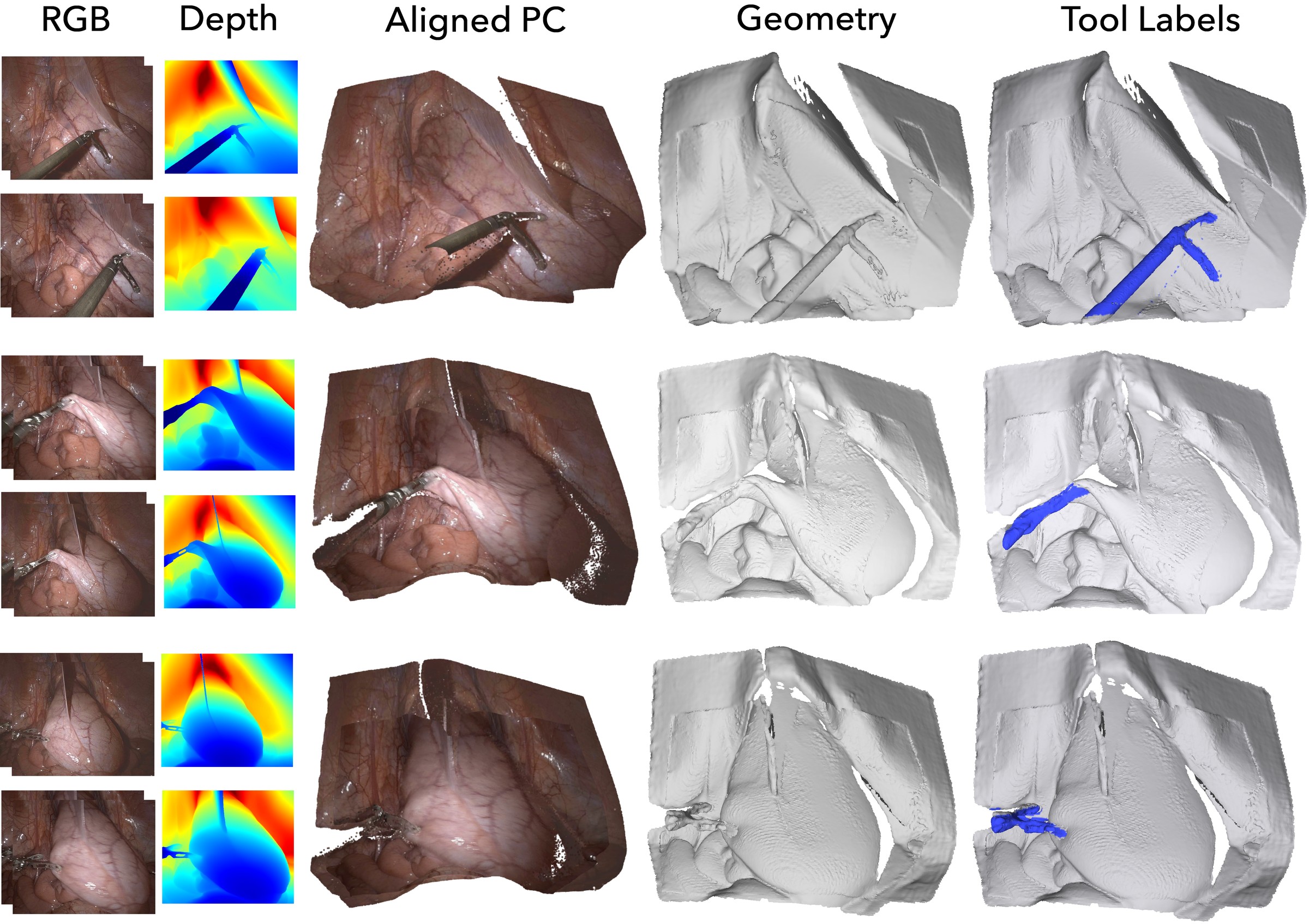 iMED figure showing RGB views, depth maps, aligned point clouds, geometry, and tool labels.