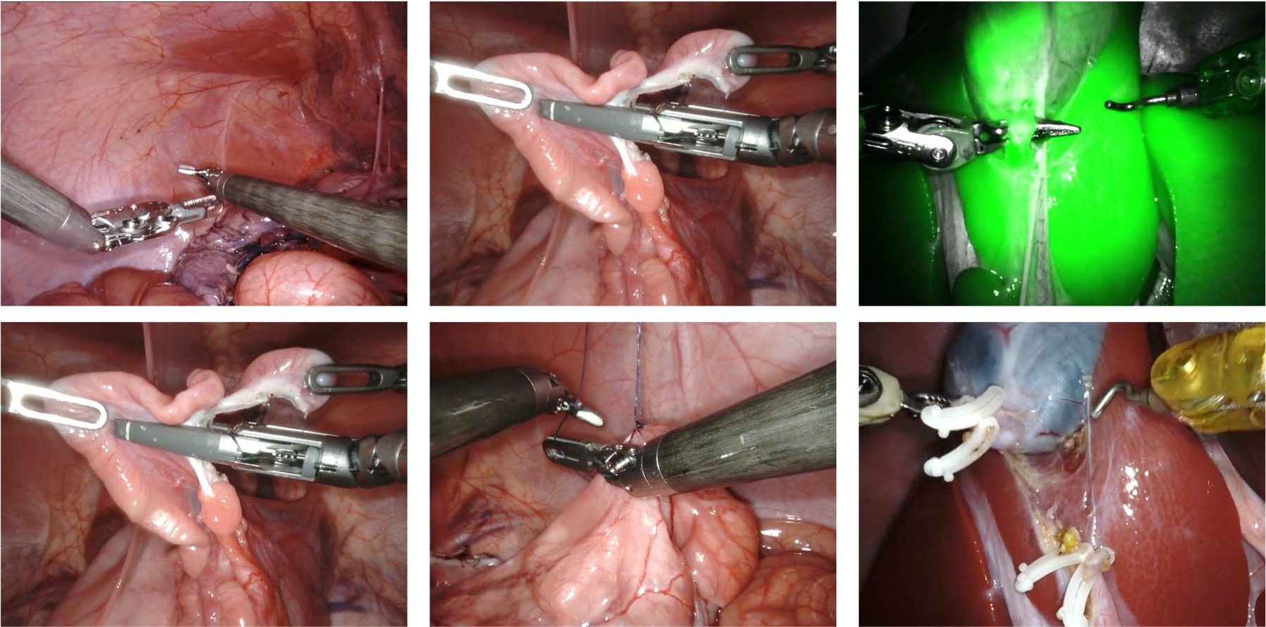 SurgVU sample frames across multiple surgical tasks.